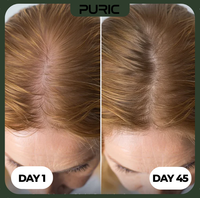 PURIC™ Advanced Rosemary Hair Growth Oil