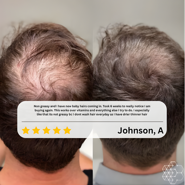 PURIC™ Advanced Rosemary Hair Growth Oil