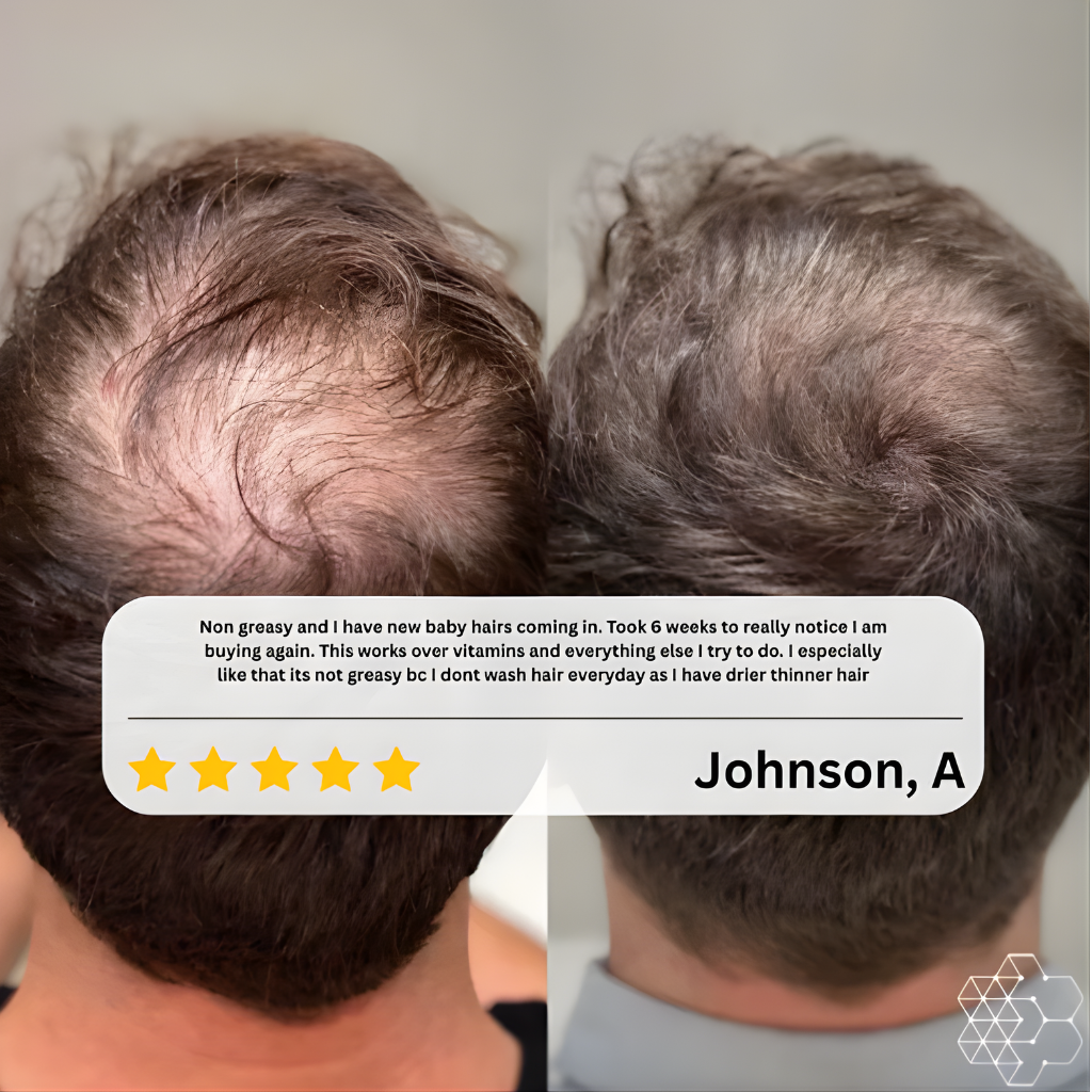 PURIC™ Advanced Rosemary Hair Growth Oil