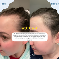 PURIC™ Advanced Rosemary Hair Growth Oil